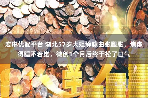 宏琳优配平台 湖北57岁大姐静脉曲张腿胀，焦虑得睡不着觉，微创1个月后终于松了口气